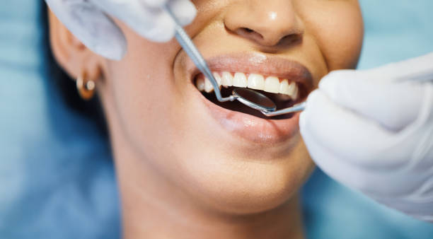 Best Emergency Dental Surgery in Hinckley, IL