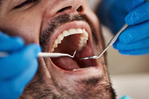 Best Emergency Broken Tooth Repair in Hinckley, IL